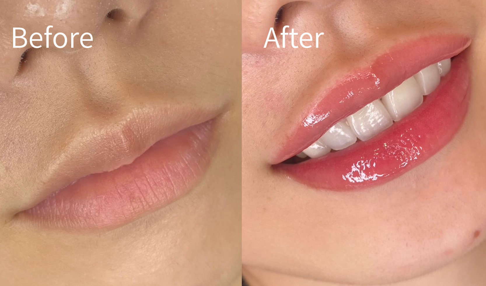 1回目定着後 Before / After