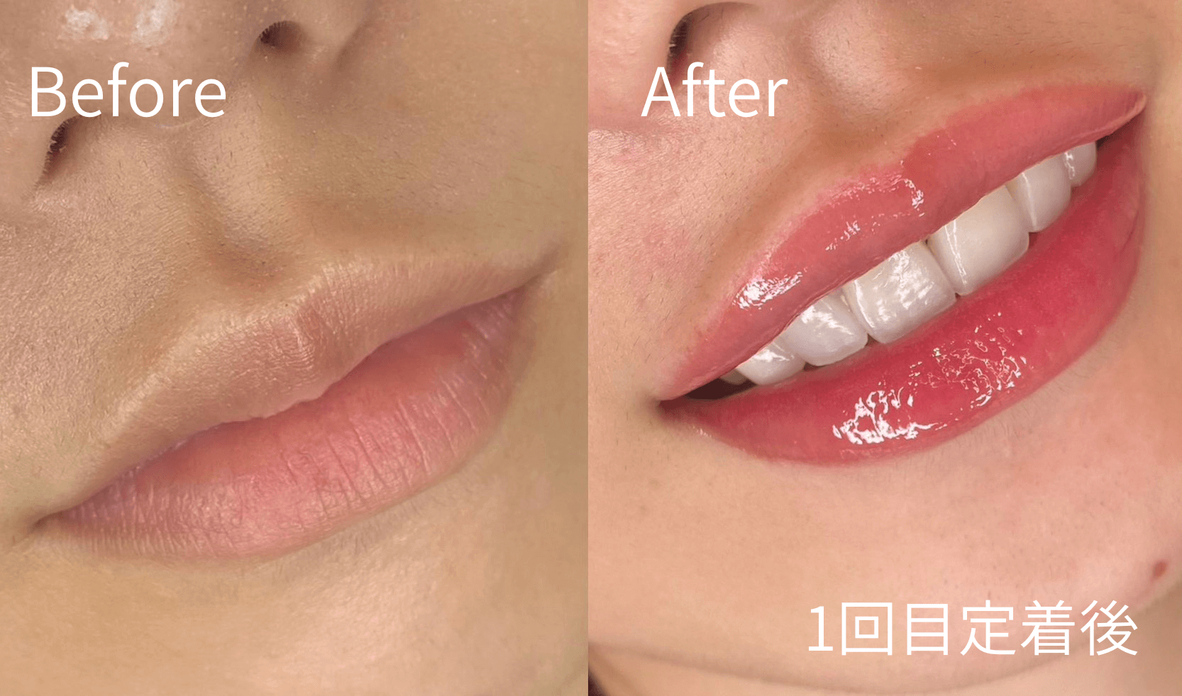 1回目定着後 Before / After