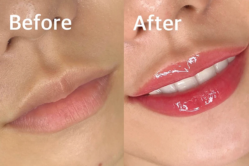 1回目定着後 Before / After